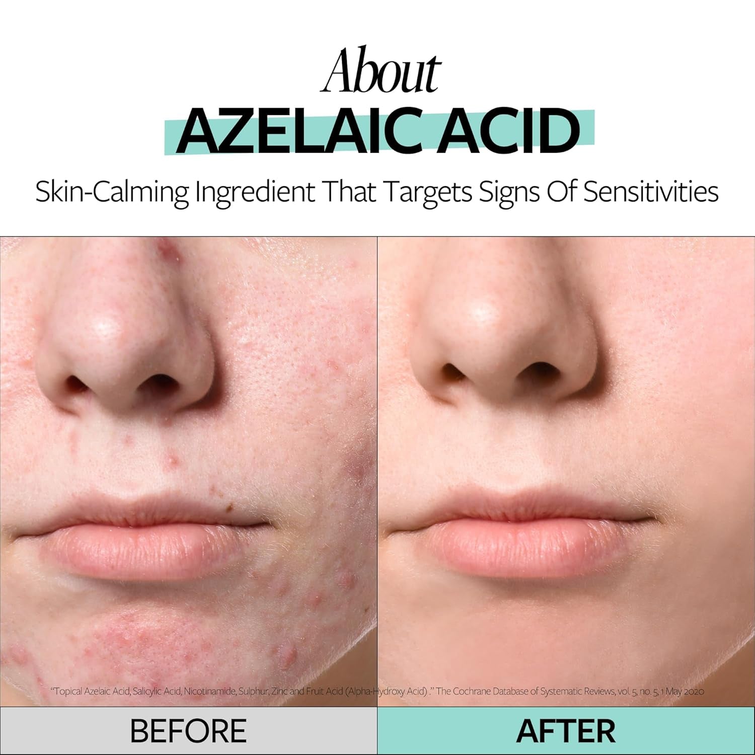 RE:CIPE 10% Azelaic Acid Soothing Ampoule – 30ml | Redness Relief, Hydration & Barrier Support