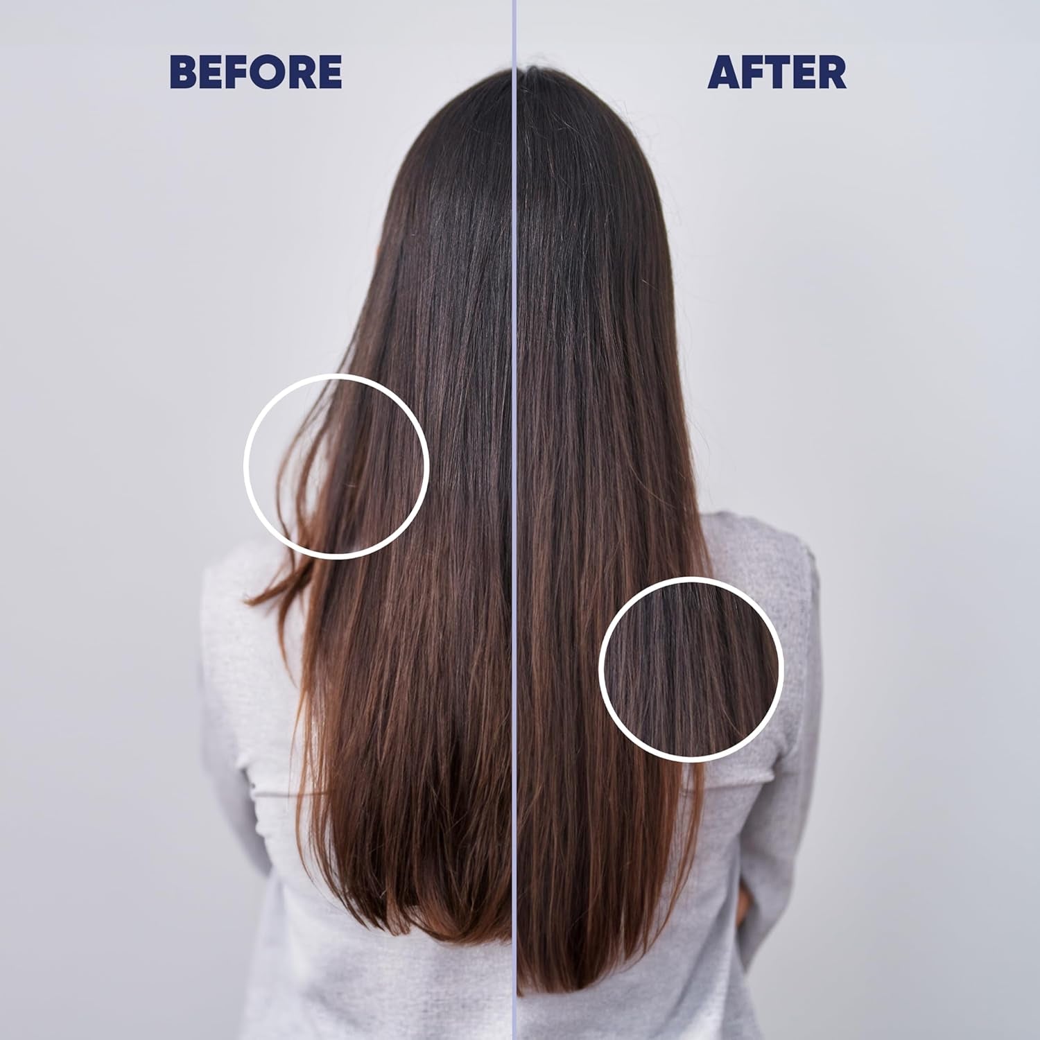 MOERIE Ultimate Hair Growth Serum – 50ml | Natural Regrowth & Thickening Treatment | Biotin, Caffeine & Amino Acids for Women