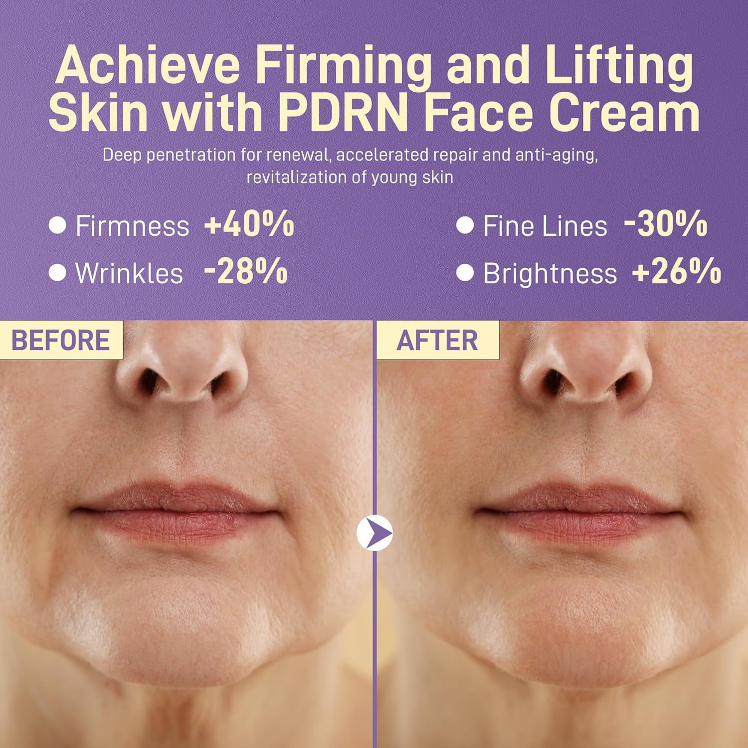 +1HEROLABS PDRN 1% (Sodium DNA) Solution Face Cream - 55g