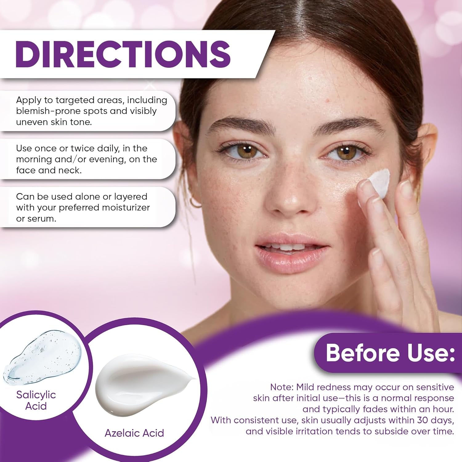 AOBBIY 14% Azelaic Acid Serum – 30ml | Advanced Acne & Redness Relief for Clear, Even Skin