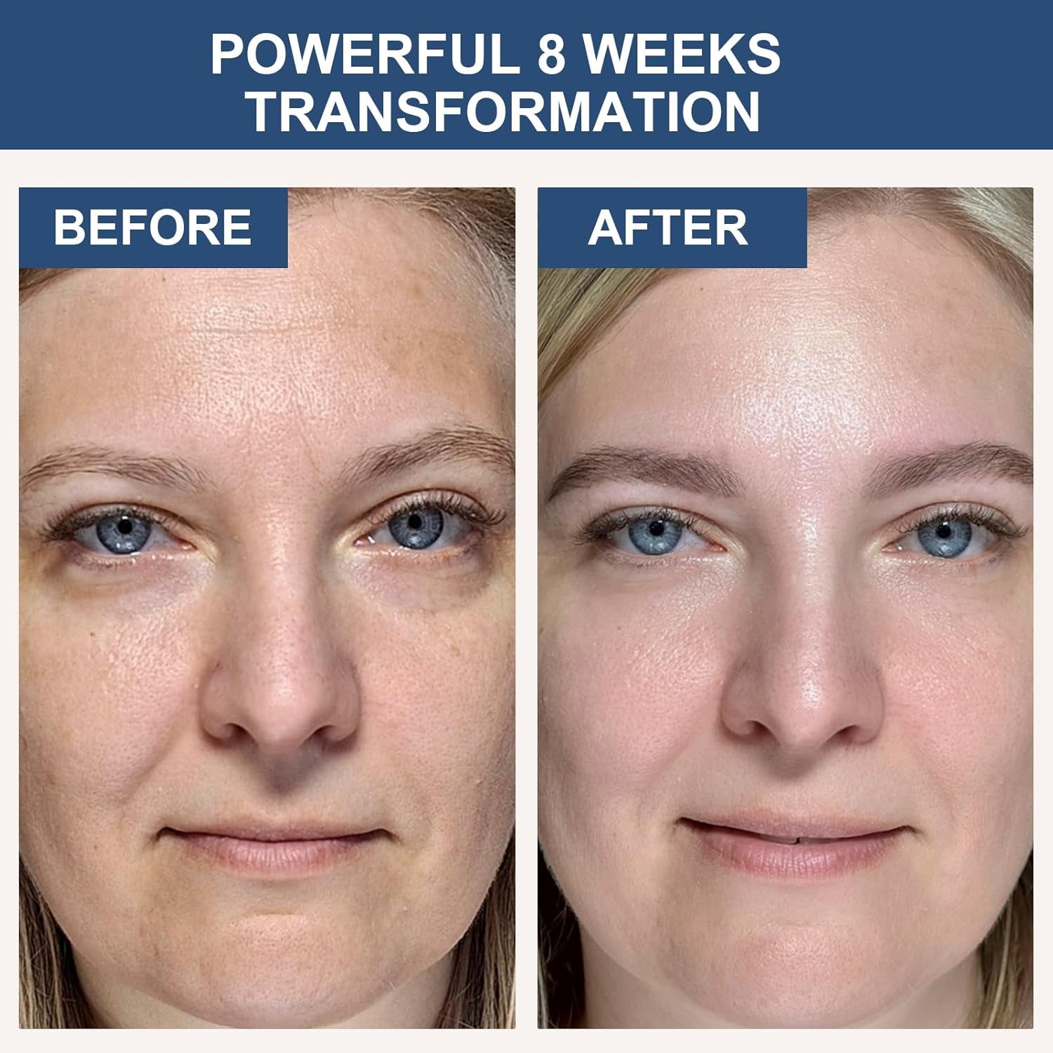 AVJONE Deep Collagen Power Boosting Mask – 35g x 4 Sheets | Overnight Anti-Aging & Firming Hydrogel Mask