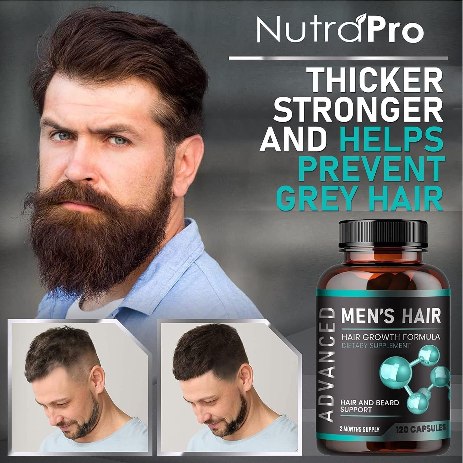 NutraPro Advanced Men’s Hair Growth – 120 Capsules | DHT Blocker & Biotin Supplement for Thicker Hair