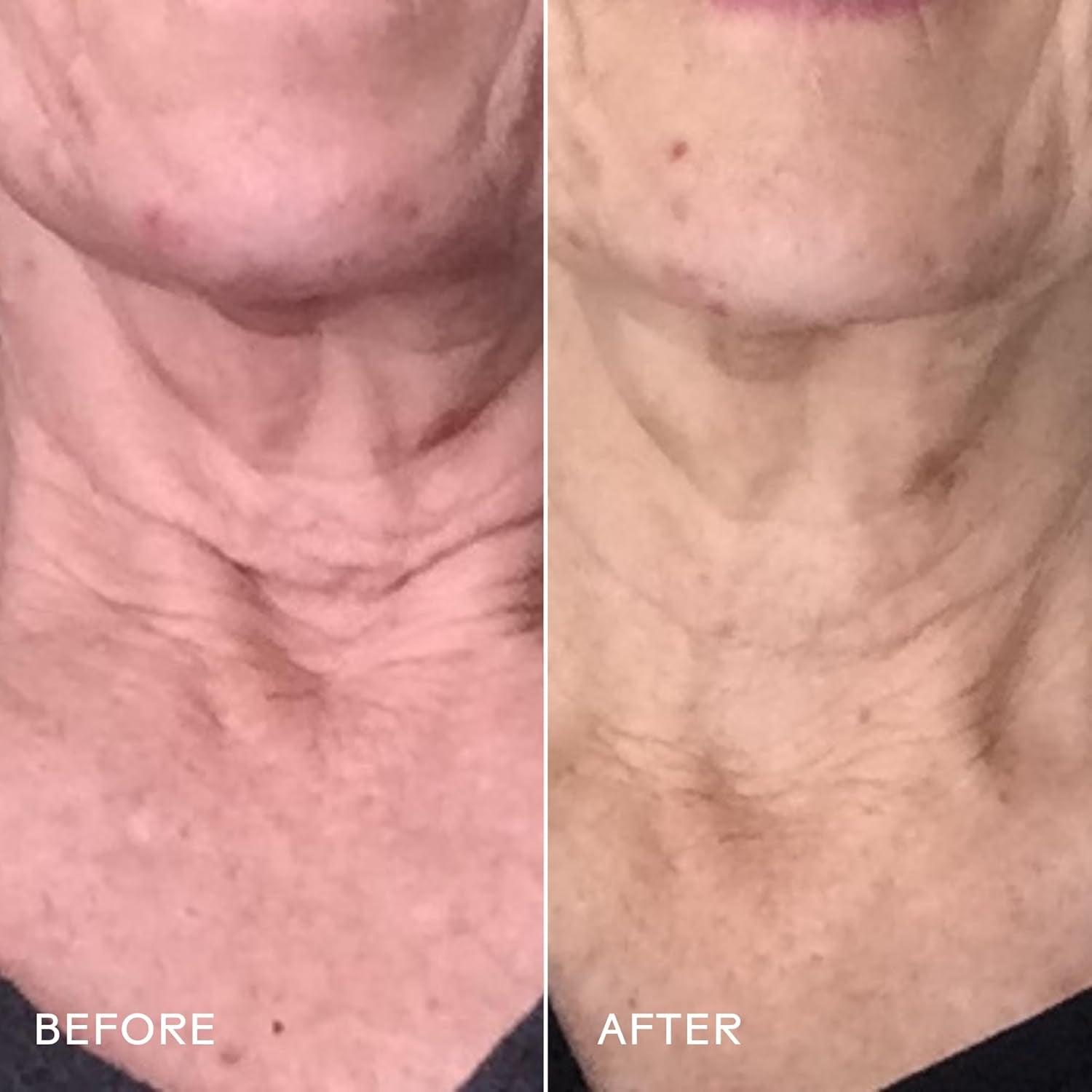 - Firm Believer Goji Stem Cell + Pomegranate Smoothing Neck + Face Cream | Moisturize, Smooth, Tone Skin | Cruelty-Free, Vegan, Paraben-Free, Sensitive Skin Safe (1.4 Oz | 40 G)