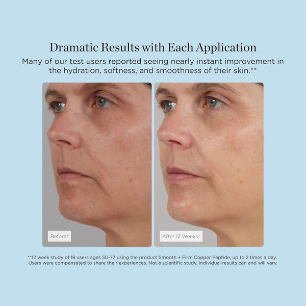 Beverly Hills MD Smooth + Firm Copper Peptide Concentrate Serum – 35ml | Lifting & Firming Anti-Ageing Gel Serum