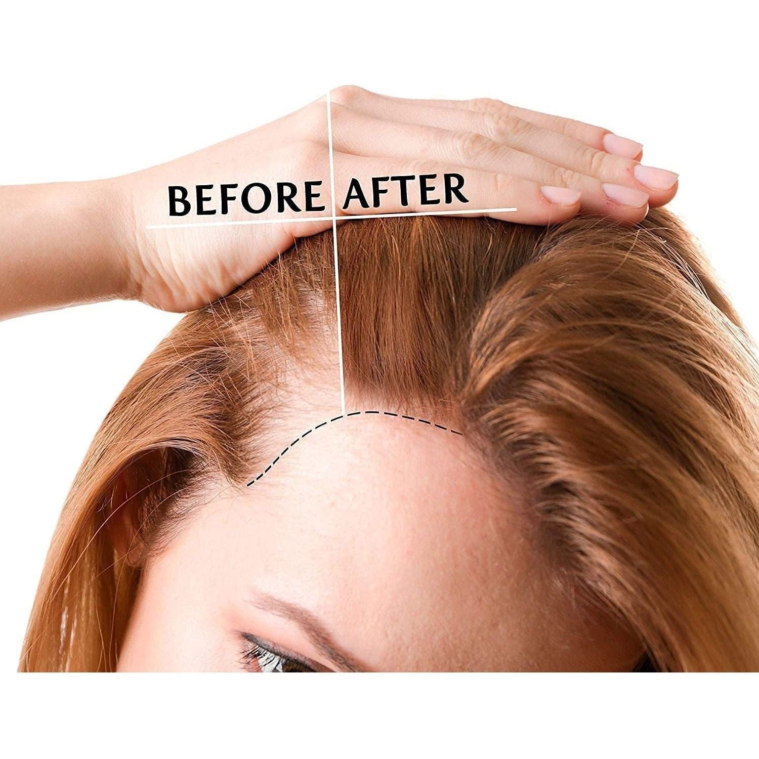 Biotin Hair Growth Oil Hair Growth Serum for Thicker Longer Fuller Healthier Hair, Prevent Hair Loss & Thinning, All Natural Vitamin Rich Treatment, Women & Men, All Hair Types 1.7 Oz