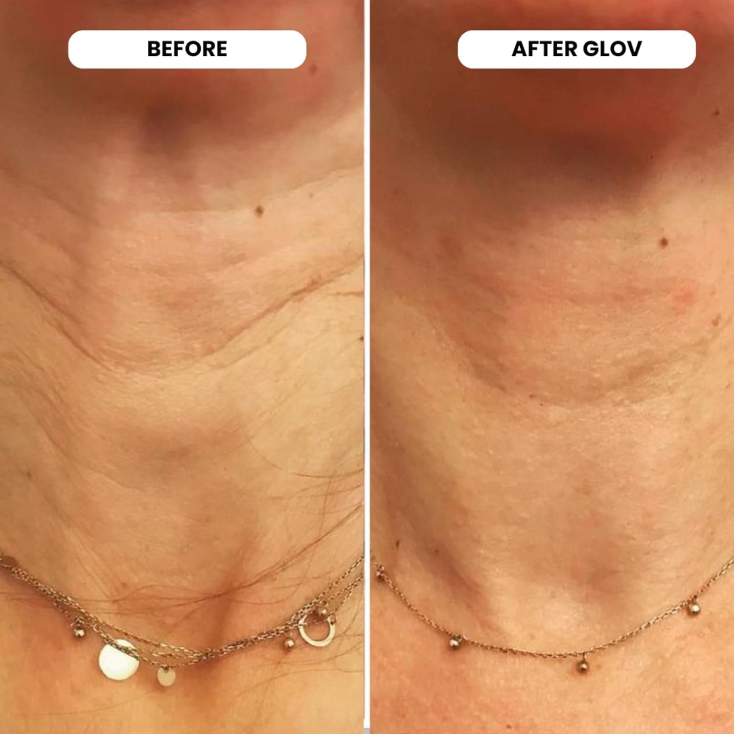 Glov Beauty Micro Infusion System - 4X Infusion Application, 12X Serums