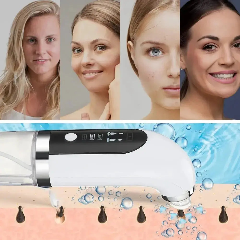 Electric Small Bubble Blackhead Remover - Glam Global UK