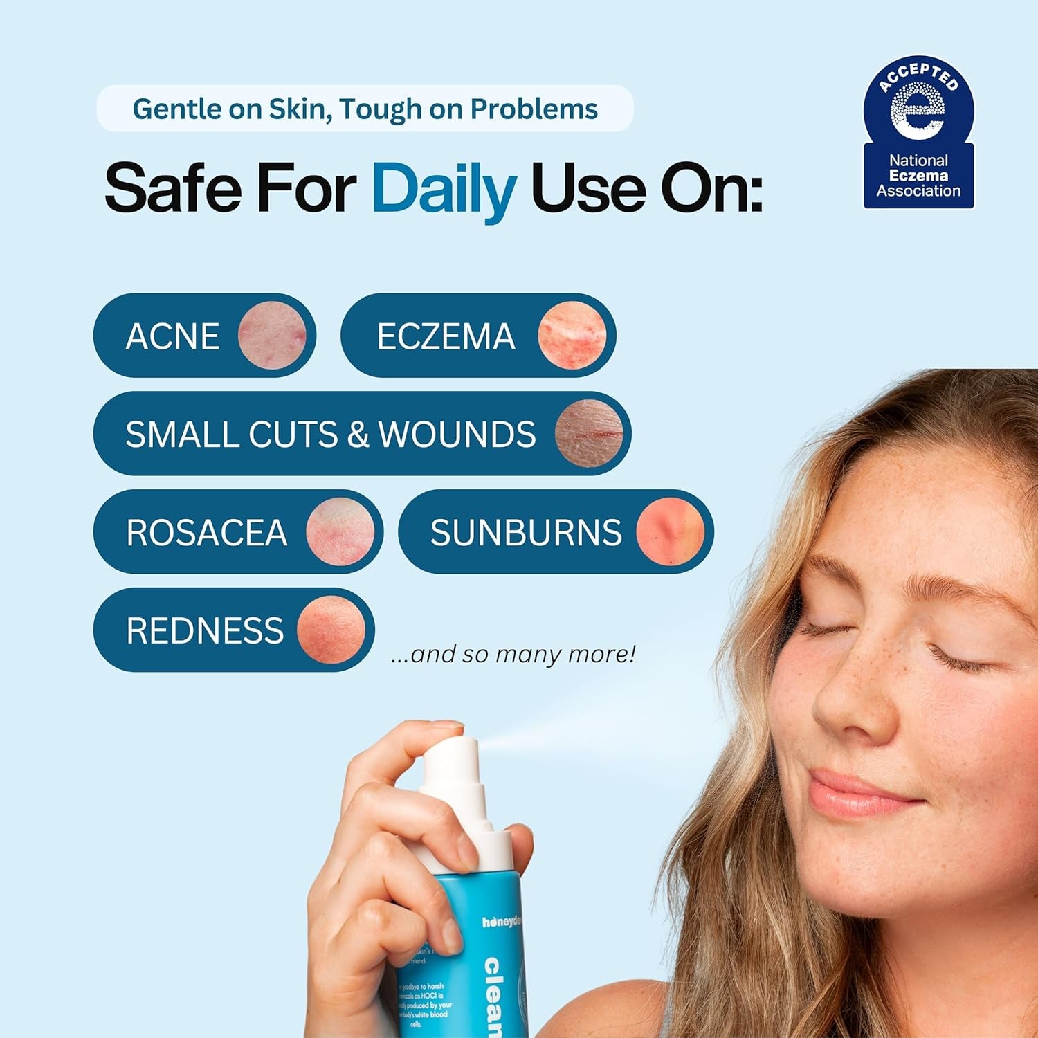 Honeydew Labs Hypochlorous Acid Face Spray – Cleanse & Soothe - 200ml