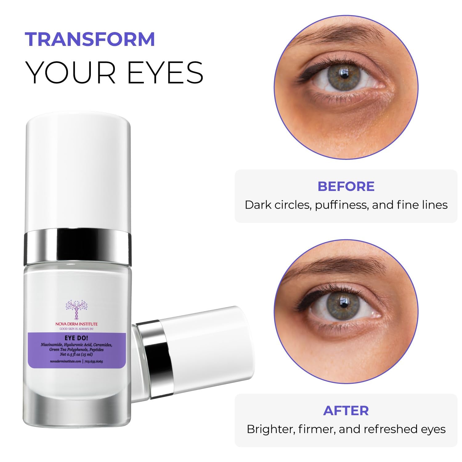 NOVA DERM INSTITUTE EYE DO! Corrective Eye Cream – 15ml | Brightens Dark Circles & Reduces Puffiness
