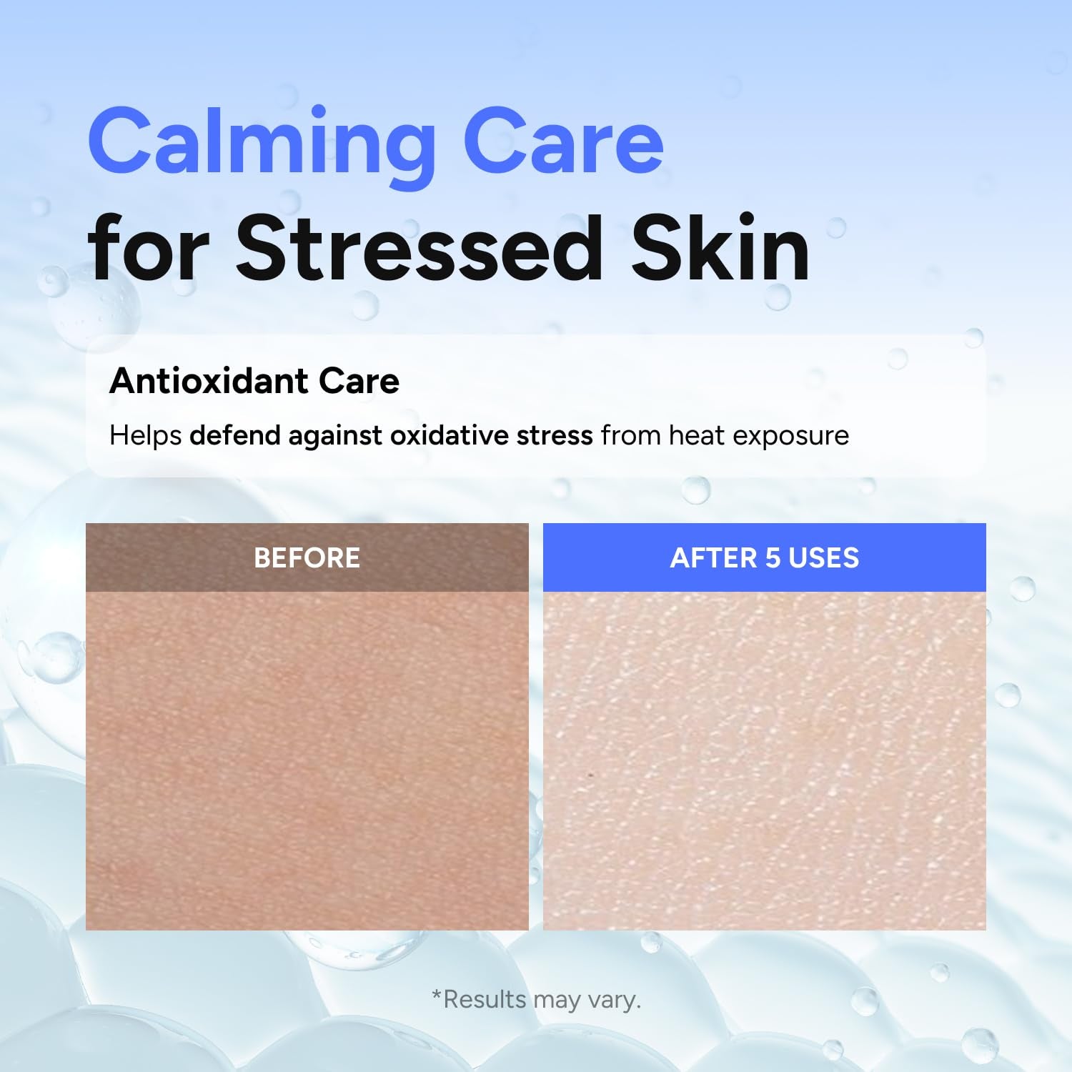 AZULENE Exosomethod Serum with Niacinamide & Panthenol for Glass Skin, Calming & Glowing Exosome Ampoule for Uneven Dull Skin Tone, Korean Skin Care (1.01 Fl Oz / 30Ml)