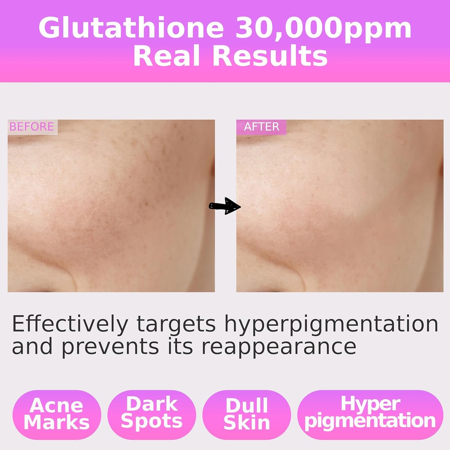 CELDYQUE Glutathione 30,000 ppm Serum – 30ml | Brightening, Hydrating & Dark Spot Care