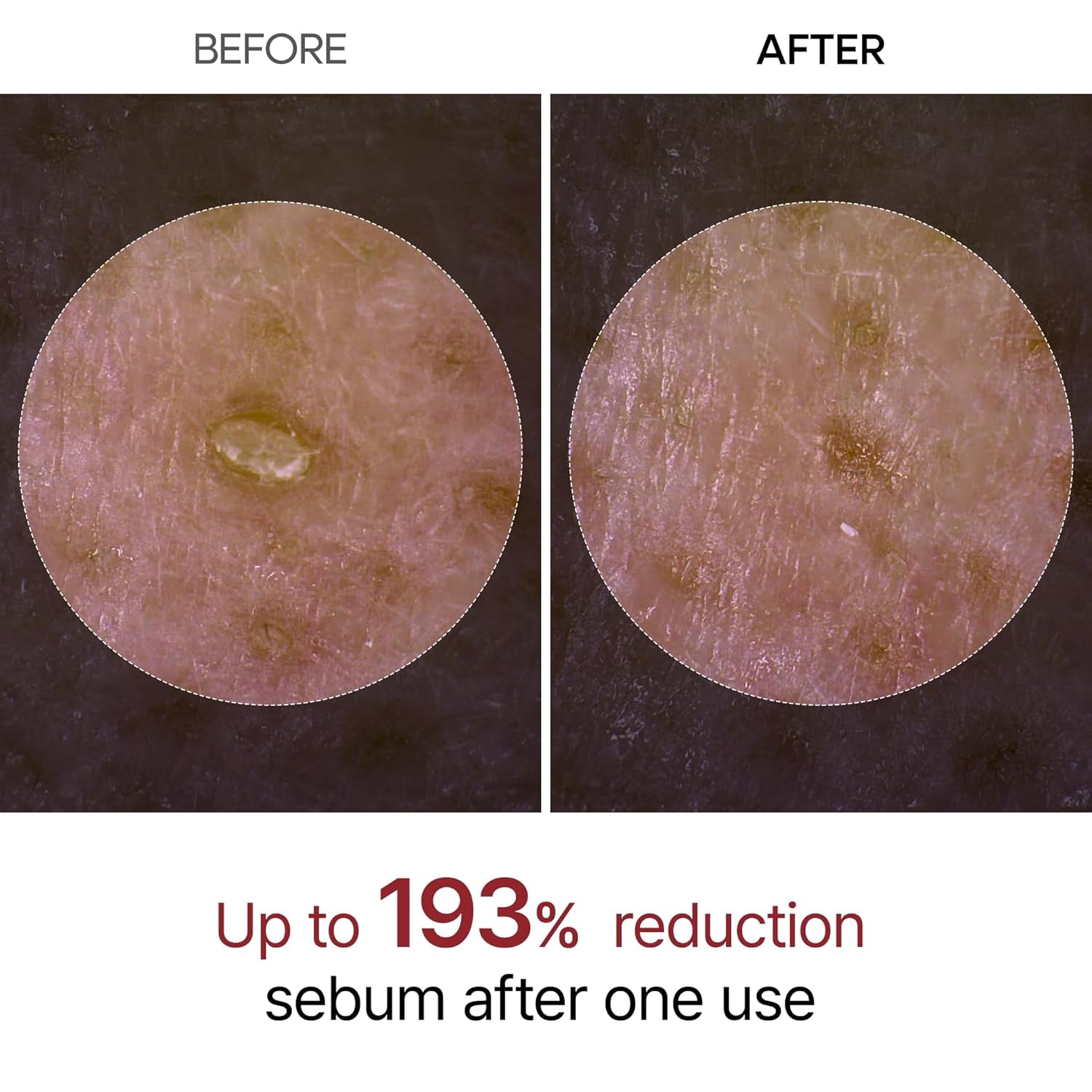 Dr.Melaxin Peel Shot Exfoliant Rice Ampoule – 80ml | Radiance-Boosting, Multi-Acid Exfoliating Ampoule with Deep Hydration