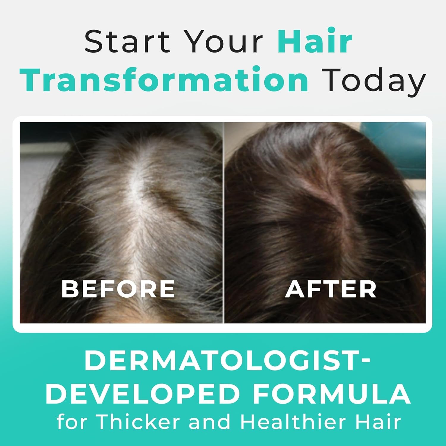 Hair Plus MD Hair Growth Supplement – 120 Capsules | Clinically Proven Formula for Thicker, Fuller Hair
