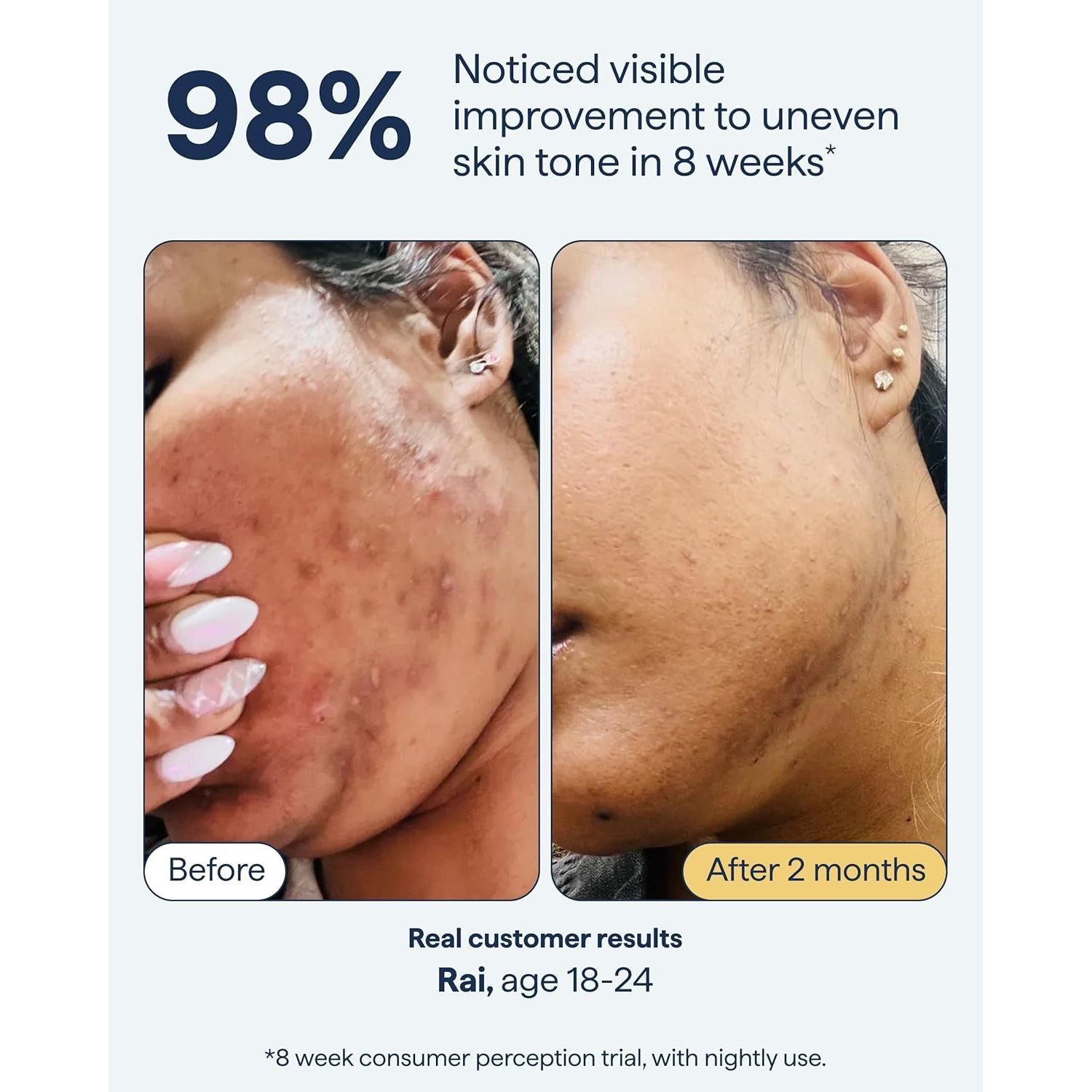 Remedy for Dark Spots Nightly All-In-One Treatment - 30ml