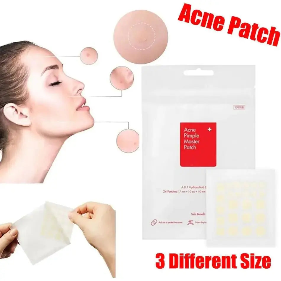 Face Acne Pimple Spot Scar Care Treatment Stickers - Glam Global UK