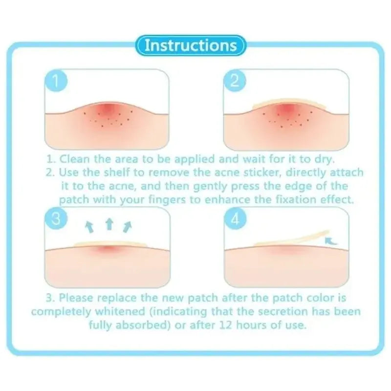 Face Acne Pimple Spot Scar Care Treatment Stickers - Glam Global UK