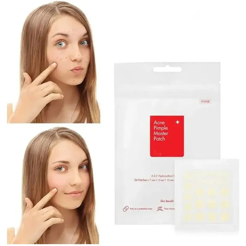 Face Acne Pimple Spot Scar Care Treatment Stickers - Glam Global UK