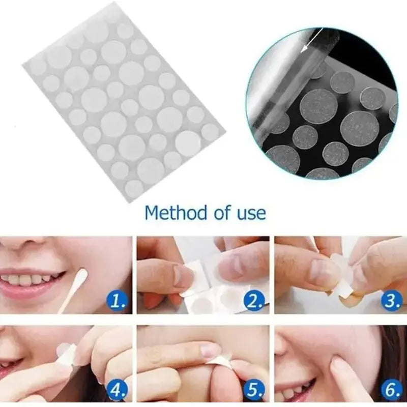 Face Acne Pimple Spot Scar Care Treatment Stickers - Glam Global UK