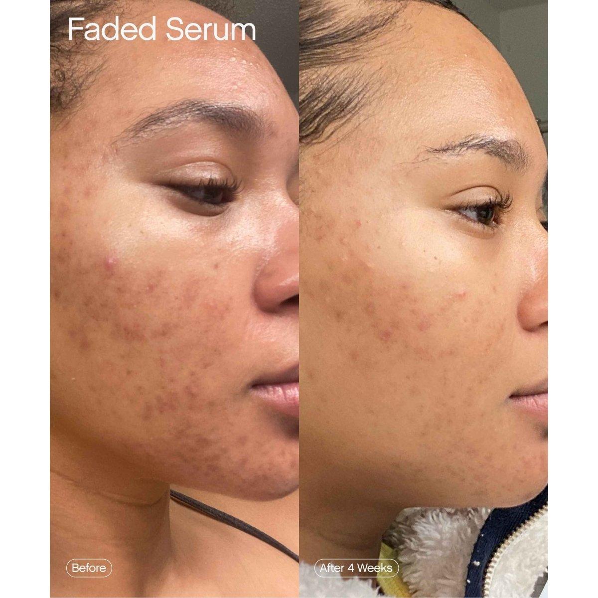 Faded Serum - Glam Global UK