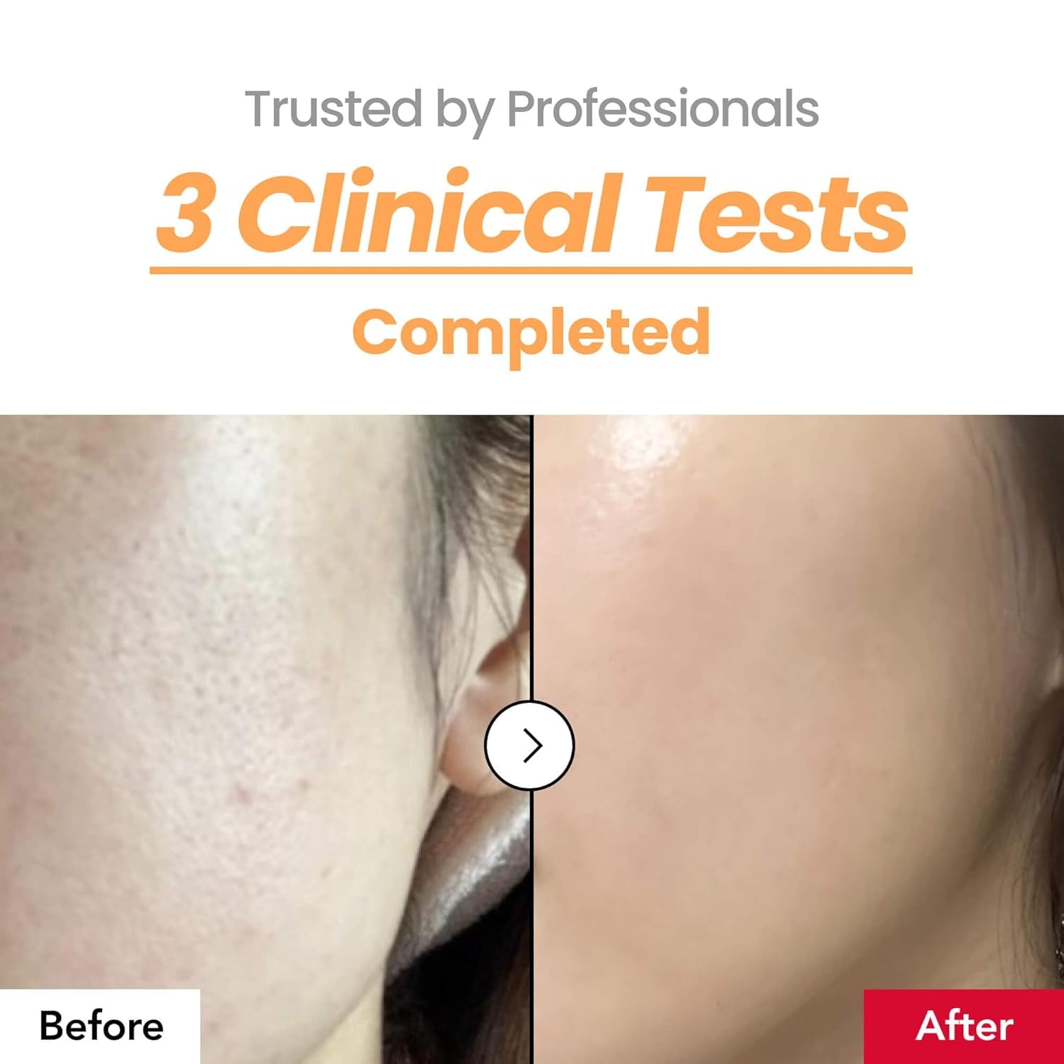 dr.percent 214% Skin Texture Booster Essence – 150ml