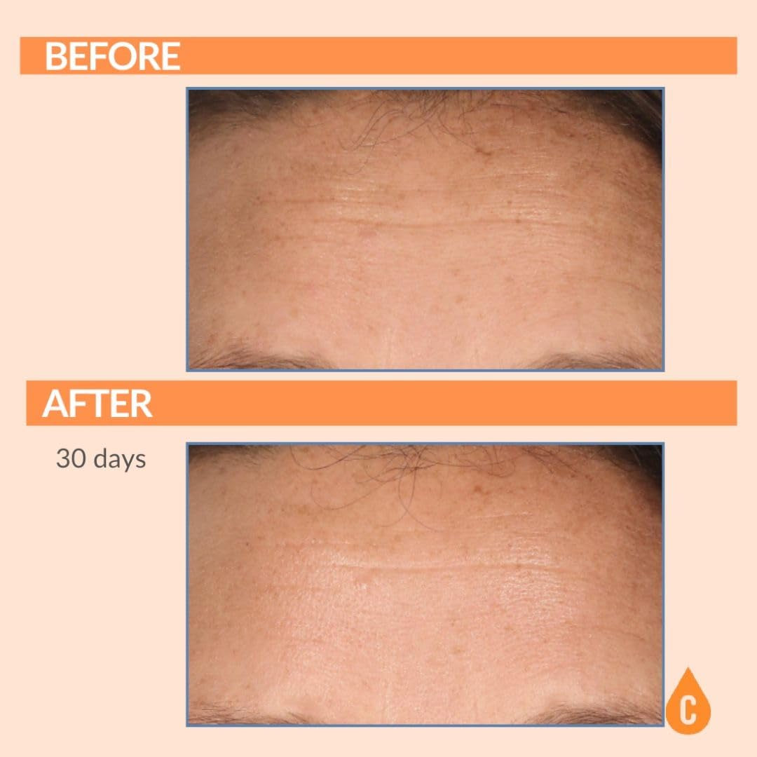 Serious Skincare Serious-C3 Plasma™ Bio Technology C Serum – 30ml | Brightening, Hydrating & Anti-Aging Treatment
