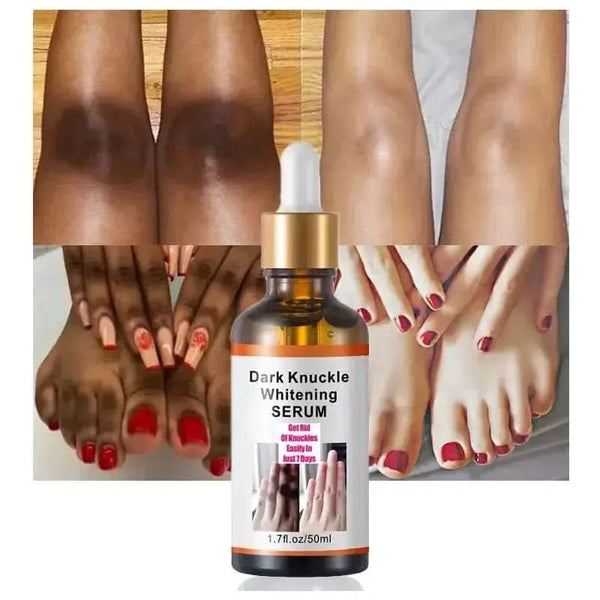 Intense Knuckle Whitening Serum: Unveil Radiant, Rejuvenated Hands - Glam Global UKGlam Global UK