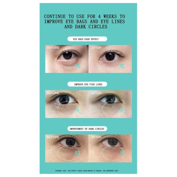 JUJY Pro iHero Eyes Care Massager - 24K Gold - Plated Eye Wrinkle & Dark Circle Solution - Glam Global UKJUJY