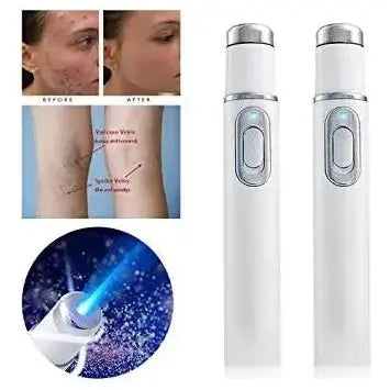 Light Therapy Acne Pen – Advanced LED Treatment for Clearer Skin - Glam Global UK