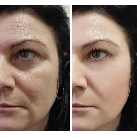 Magic Cream Face Lift - Glam Global UK