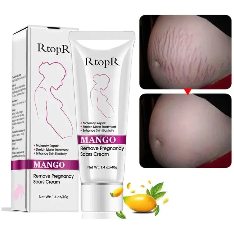 Mango Stretch Mark Cream For Pregnancy Repair - Glam Global UK