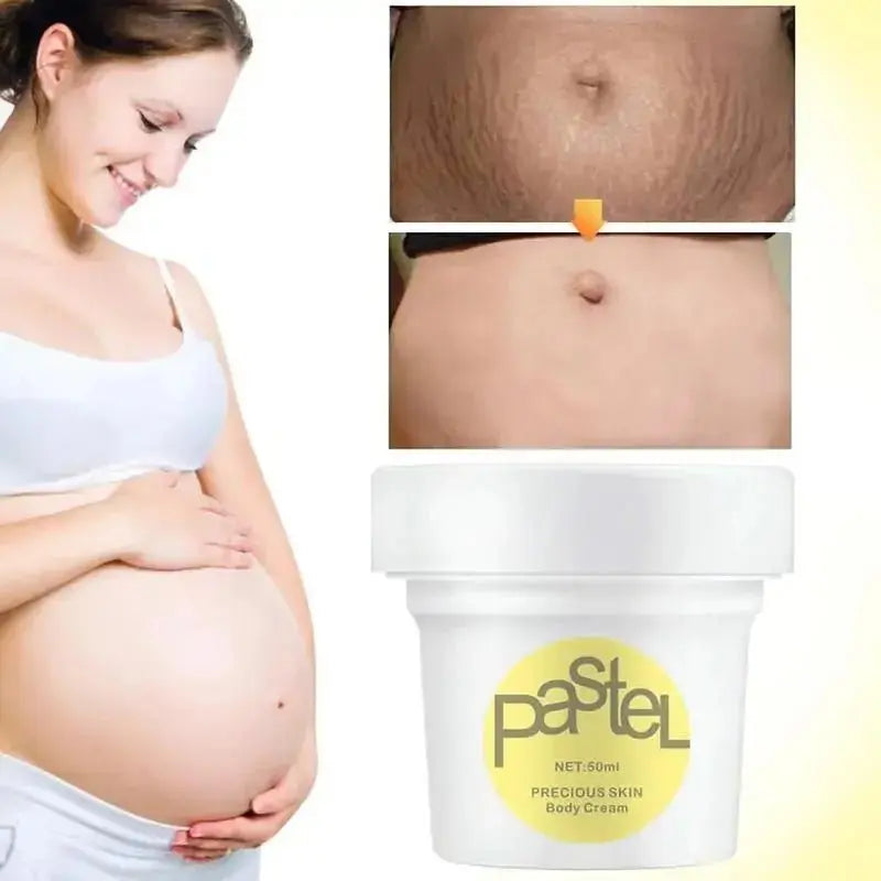 Maternity Stretch Marks Cream - Glam Global UK