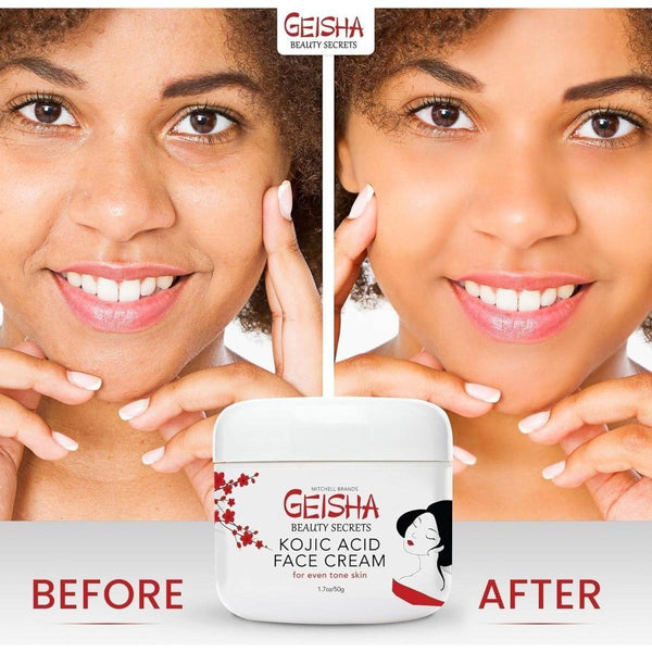 Mitchell Brands Geisha Kojic Acid Cream - 50ml - Glam Global UKMitchell Brands