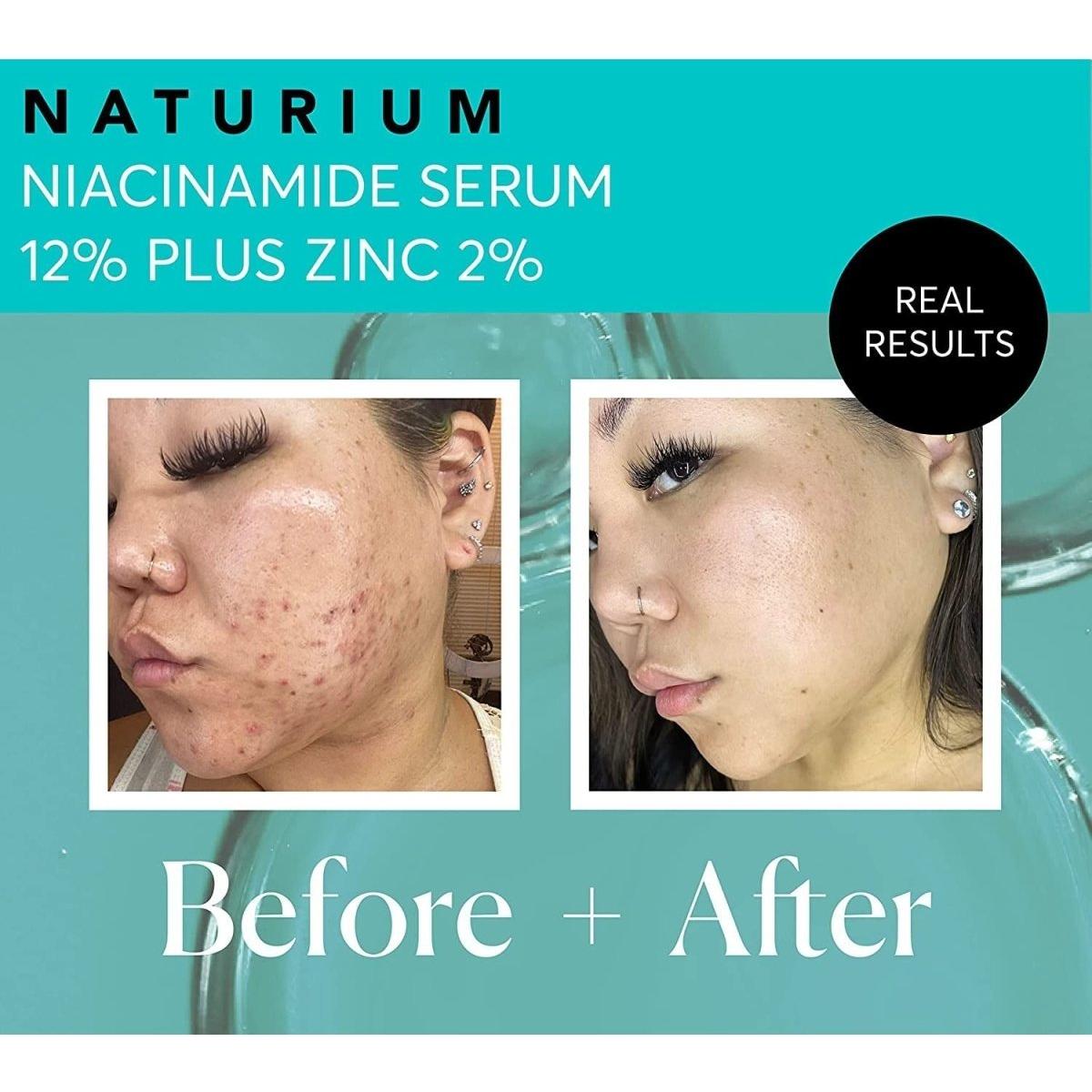 Naturium Niacinamide Face Serum 12% Plus Zinc 2% 2 fl oz - 60 ml - Glam Global UKNaturium