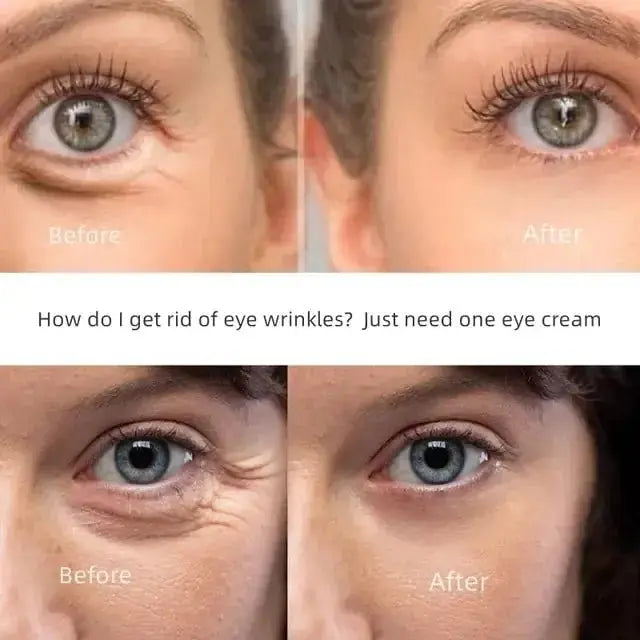 New Anti - Wrinkle Eye Cream - Glam Global UK