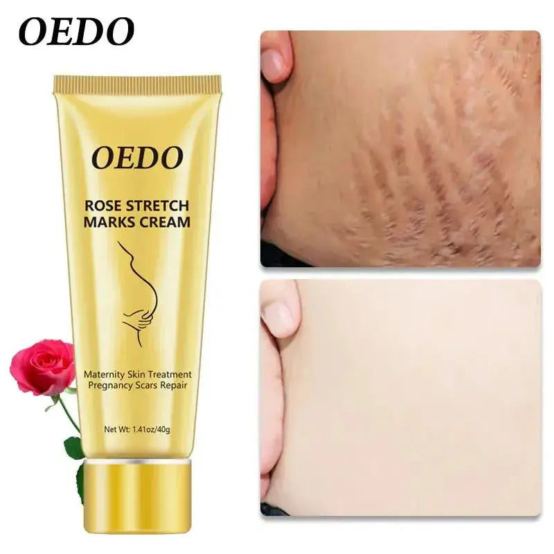 OEDO Stretch Mark Cream - Glam Global UK