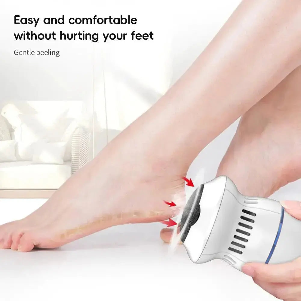 Portable Vacuum Callus Remover - Glam Global UK