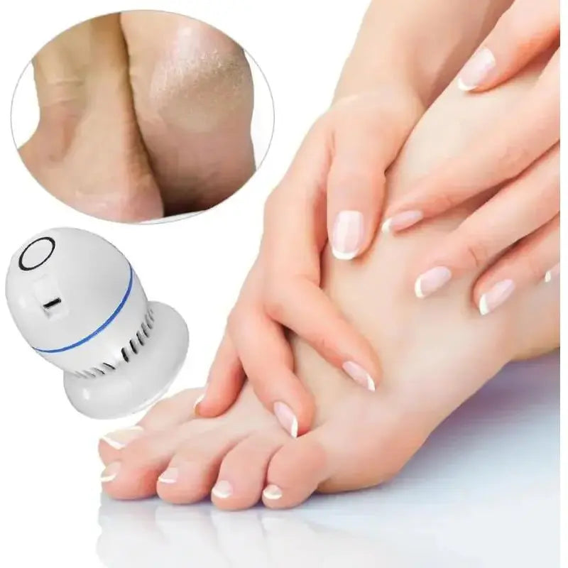 Portable Vacuum Callus Remover - Glam Global UK