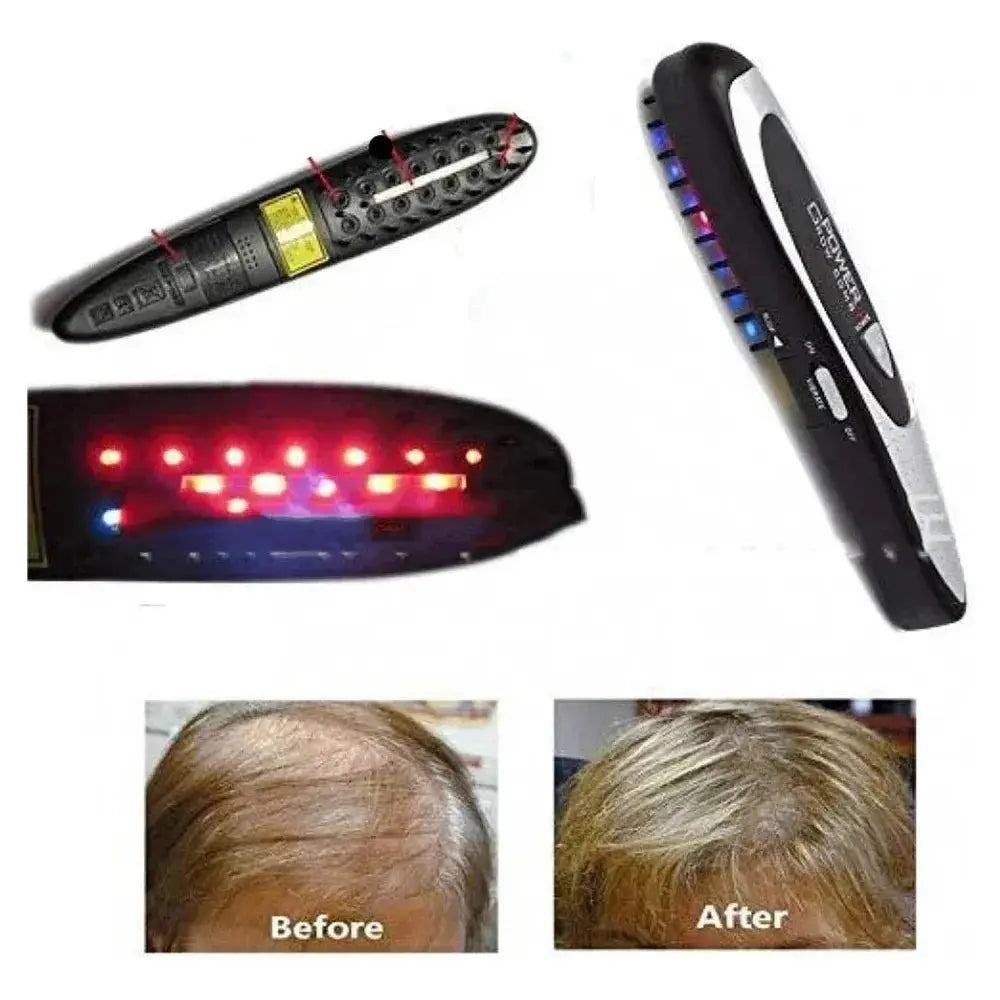 Power Grow Comb | Electric Laser Treatment Comb for Hair Regeneration & Loss Prevention - Glam Global UK