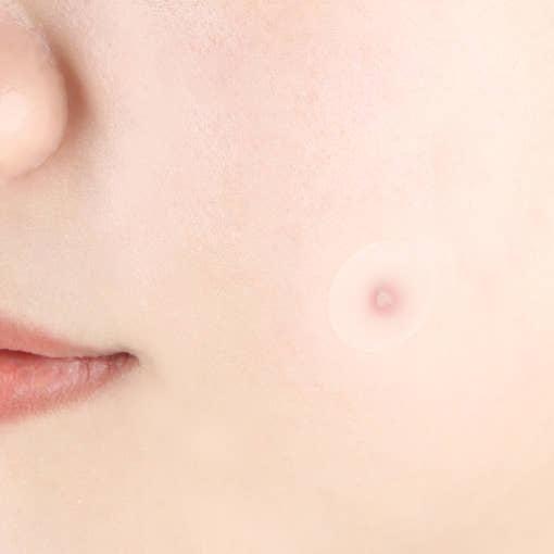 [Pyunkang Yul] Clear Spot Patch (18ea X 4ea) - Glam Global UKPyunkang Yul