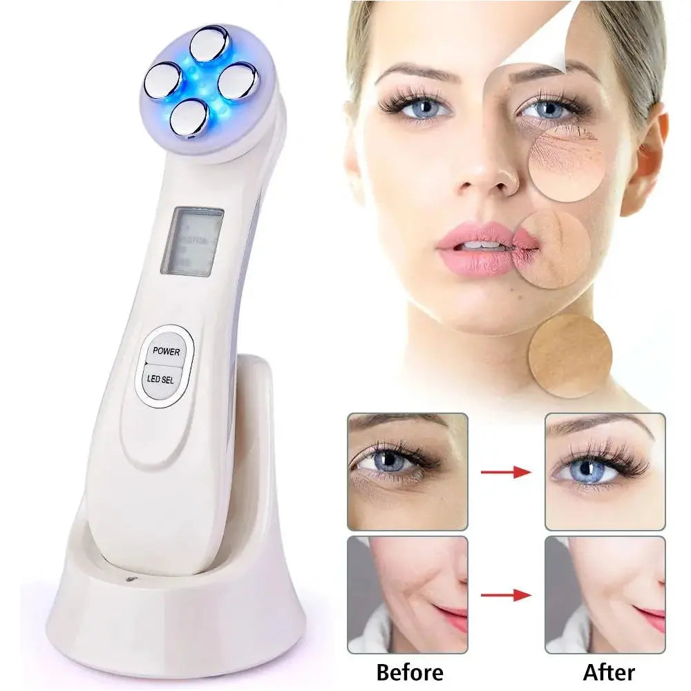 RF EMS LED Photon Facial Rejuvenation Device – Acne & Wrinkle Treatment - Glam Global UK