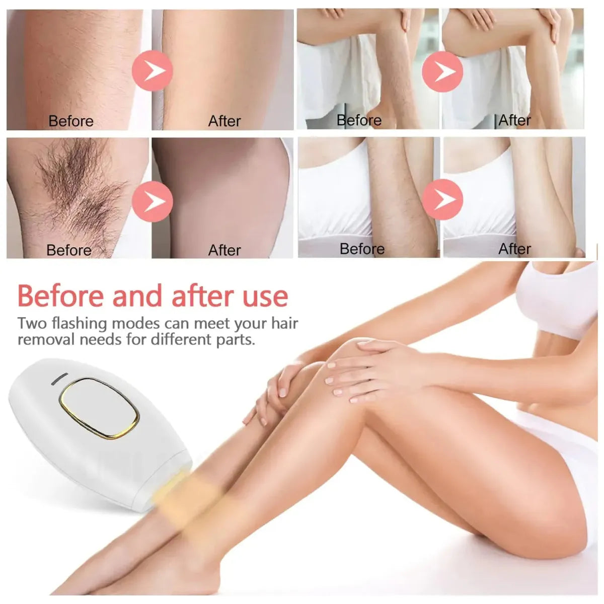 Shaver Permanent Hair Removal - Glam Global UK