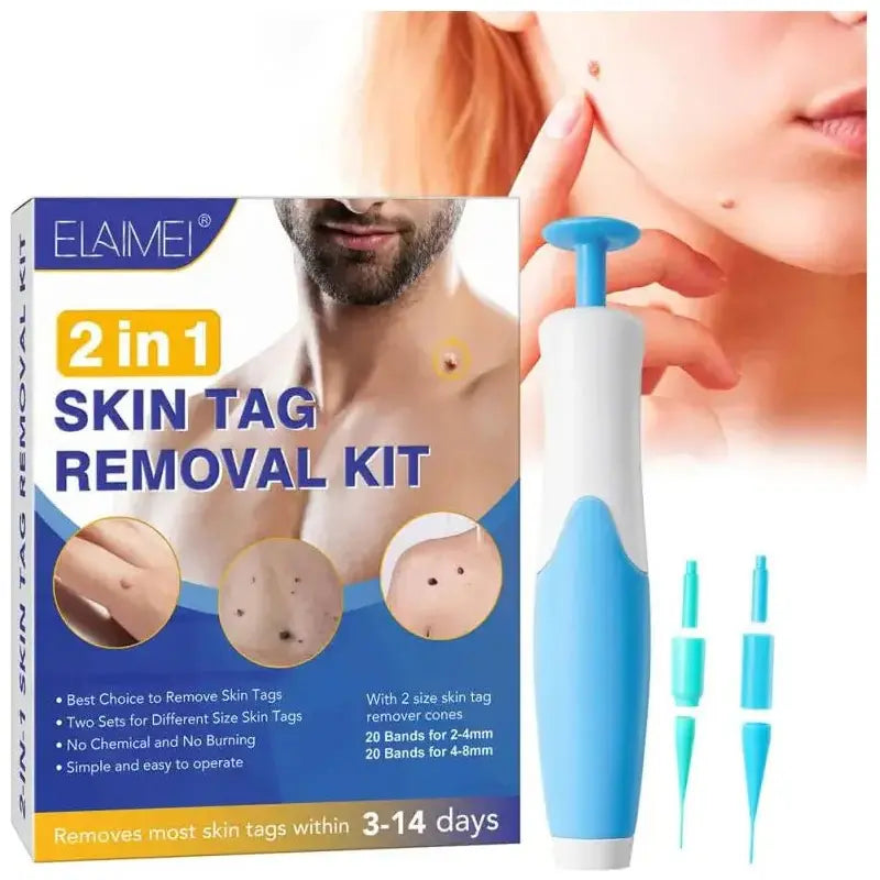 Skin Tag Remover Kit - Glam Global UK