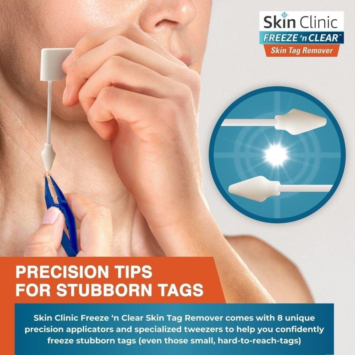 Skin Clinic FREEZE 'n CLEAR Skintag Remover 8 Applicators + Tweezers - Glam Global UKSkin Clinic