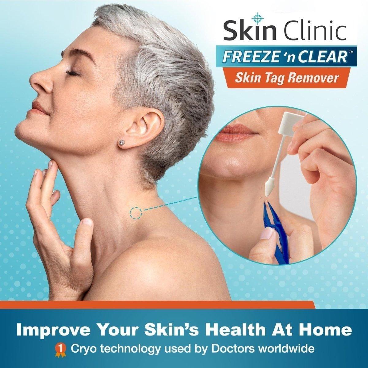 Skin Clinic FREEZE 'n CLEAR Skintag Remover 8 Applicators + Tweezers - Glam Global UKSkin Clinic