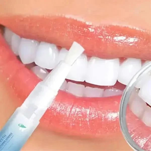 Teeth Whitening Pen – Achieve a Brighter, Radiant Smile Anywhere - Glam Global UKGlam Global UK