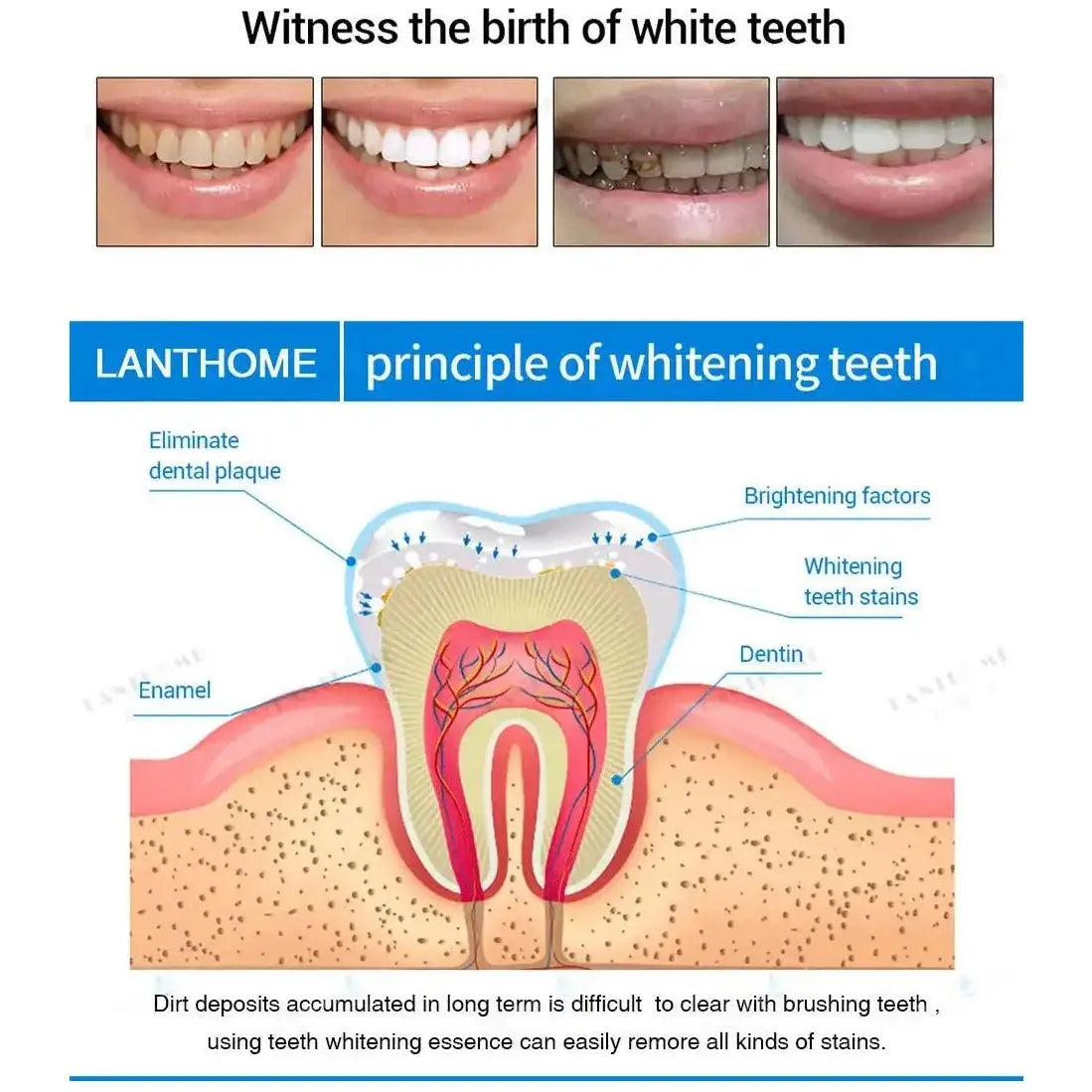 Teeth Whitening Pen - Glam Global UK