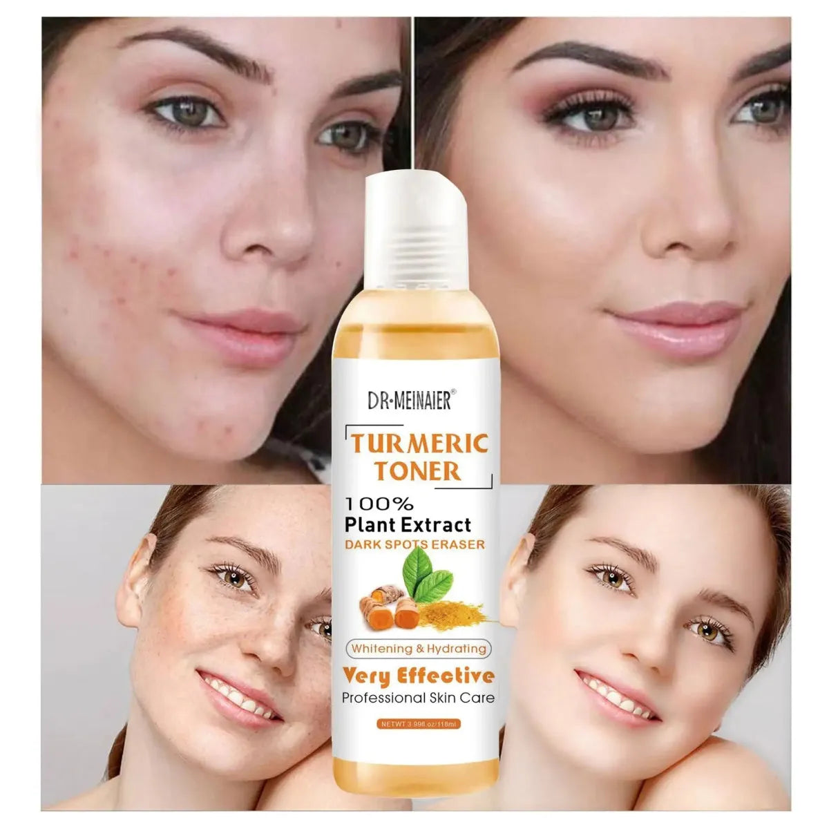 Turmeric Moisturizing Toner - Glam Global UK