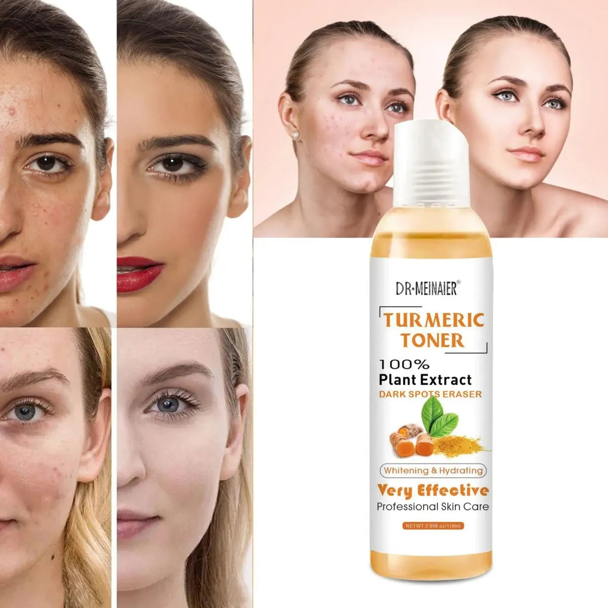 Turmeric Moisturizing Toner - Glam Global UK