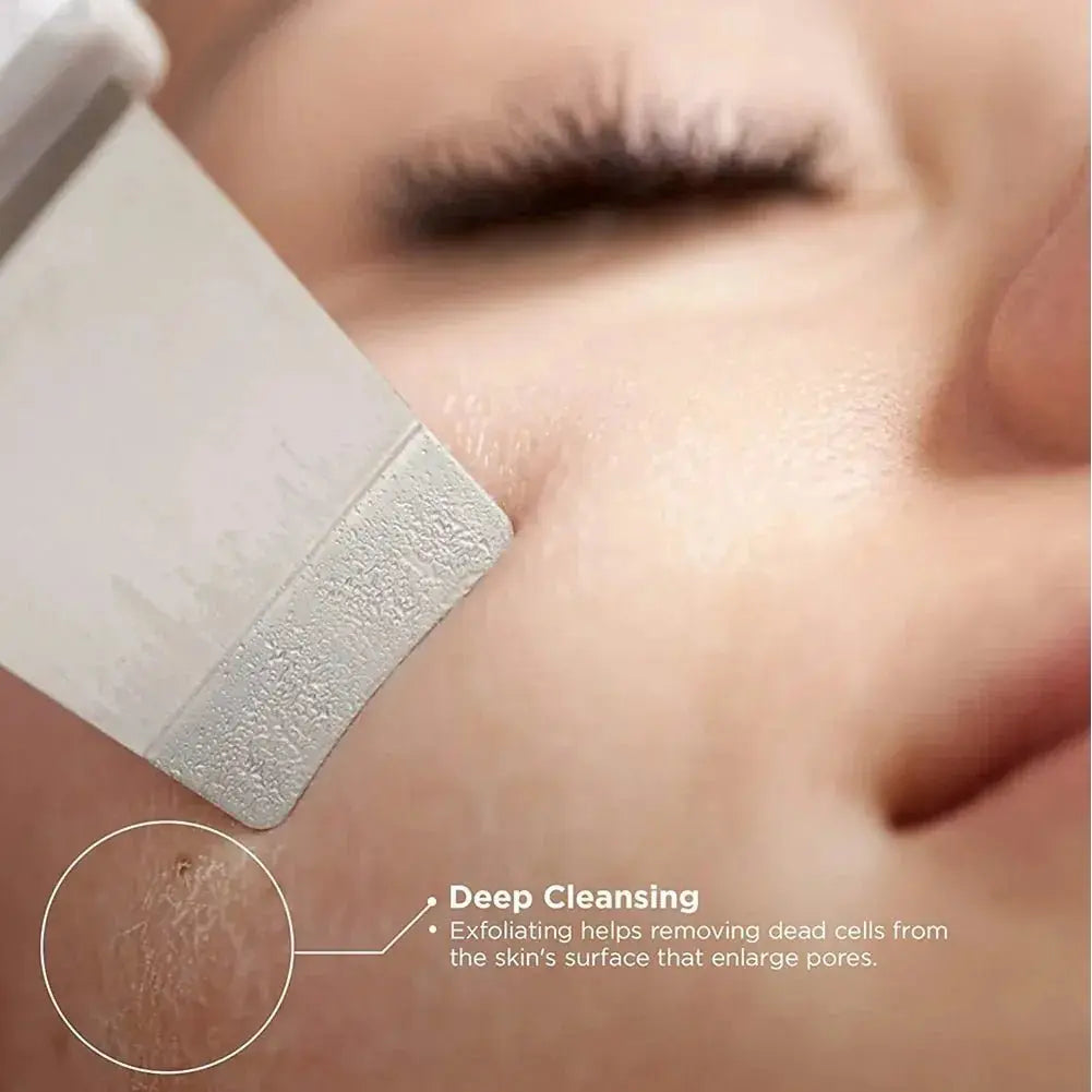 Ultrasonic Face Skin Scrubber - Glam Global UK