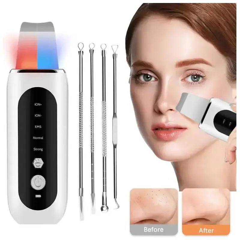 Ultrasonic Face Skin Scrubber - Glam Global UK